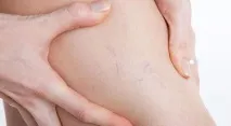 ціна