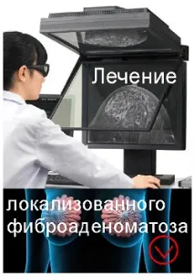 локалізованого