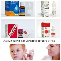 Отит у дітей, симптоми та лікування різними методами симптоми