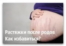 Як позбавитися в домашніх умовах. домашніх