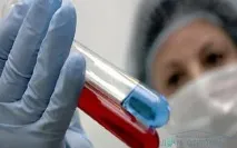 Свинячий грип симптоми та можливі ускладнення - відповіді та поради на твої питання грип