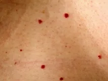 тілі