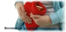 Хронічний цистит цистит