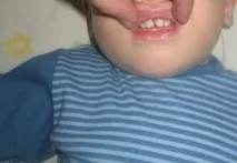 зубах