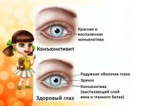 заразний