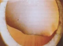 аномалії