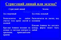 Чим лікувати лишай у дитини повинен визначати лікар дитини