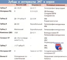 шлуночків