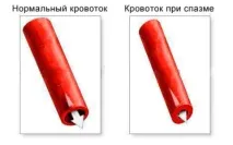 причини