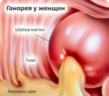 захворювання