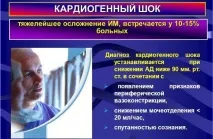 Інфаркт міокарда після