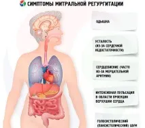 Інфаркт міокарда інфаркту