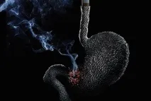 Як швидко кинути палити ефективні та марні способи кинути