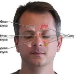 Лікуємо гайморит в домашніх умовах, Народна медицина діагностика та лікування захворювань лікуємо