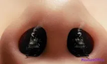 причини