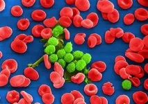 Лімфолейкоз хронічний симптоми, перебіг, розпізнавання перебіг