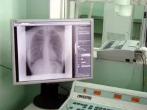 Курс променевої діагностики та ендоскопії факультету підвищення кваліфікації та професійної курс