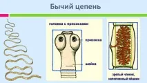людині