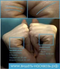 ЛІНІЇ ШЛЮБУ шлюбу