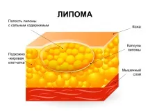 видалення