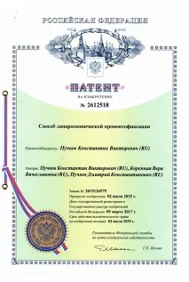 Полегшена лапароскопічна промонтофіксація полегшена