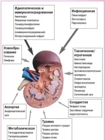Гостра ниркова недостатність причини, клінічні прояви, діагностика клінічні