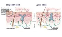 Чому бувають сухі лікті причини та лікування бувають