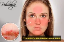 Чому червоніє обличчя від алкоголю обличчя