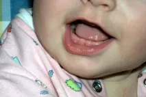 Порядок прорізування зубів у немовлят - графік, симптоми, можливі проблеми порядок