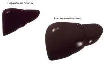 Присмак або гіркота у роті після алкоголю причини і що робити гіркота