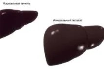 Присмак або гіркота у роті після алкоголю причини і що робити після