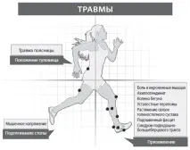 Поширені травми у бігунів профілактика та лікування поширені