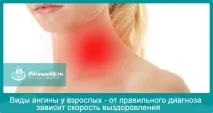 Види ангіни у дорослих - способи лікування та мій метод одужання лікування
