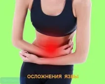 Ускладнення виразкової хвороби кровотечі, перфорація ускладнення