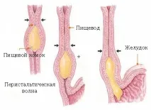 структура