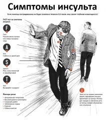 Перші симптоми інсульту та 7 заходів екстреної долікарської допомоги - Технополіс завтра перші