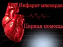 міокарда