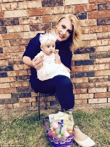 21-Літня дівчина, яка втратила обидві ноги, знялася у відвертій фотосесії, щоб показати, що такі (дівчина) 21-Літня дівчина, яка втратила обидві ноги, знялася у відвертій фотосесії, щоб показати, що такі