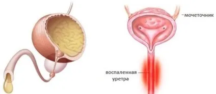 Антибіотики при уретриті у чоловіків і жінок (наші Новомосковсктелі радять) Антибіотики при уретриті у чоловіків і жінок