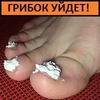 Бактерії в організмі людини, корисні і шкідливі їх роль, кількість, вагу, способи проникнення, (корисні) Бактерії в організмі людини, корисні і шкідливі їх роль, кількість, вагу, способи проникнення,