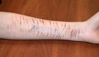 Біжи або помри »,« синій кит »,« розбуди мене в 4 20 »як уберегти дитину від« груп смерті »в мережі - (вберегти від груп смерті) Біжи або помри »,« синій кит »,« розбуди мене в 4 20 »як уберегти дитину від« груп смерті »в мережі -