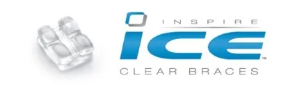 Брекети inspire ice опис, відгуки та установка (inspire) Брекети inspire ice опис, відгуки та установка