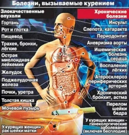 Кинути палити - інвестиція в здоров'я №1 (інвестиції в здоров'я) Кинути палити - інвестиція в здоров'я №1