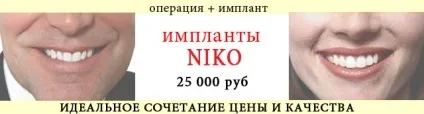 Бюджетні імпланти зубів, імплантанти зубні, види протезування на імплантатах, види зубних (види) Бюджетні імпланти зубів, імплантанти зубні, види протезування на імплантатах, види зубних