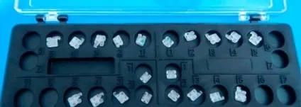 Чим брекети inspire ice відрізняються від інших
