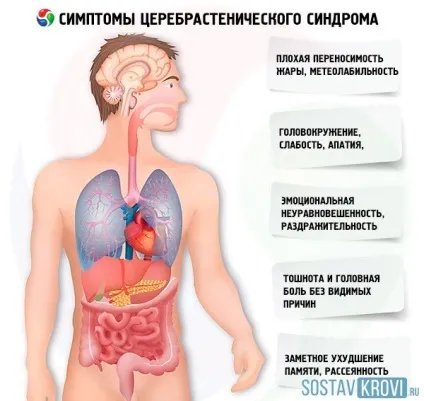 Церебрастенический синдром причини, симптоми, у дітей, дорослих, лікування