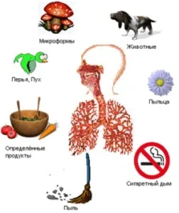 Що робити при алергічному набряку горла - перша допомога (робити) Що робити при алергічному набряку горла - перша допомога