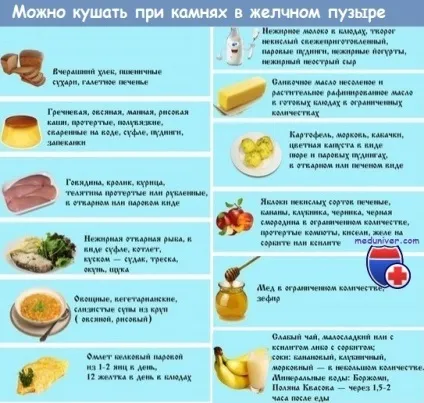 Що можна і не можна їсти, якщо є камені в жовчному міхурі дієта при холециститі (їсти) Що можна і не можна їсти, якщо є камені в жовчному міхурі дієта при холециститі