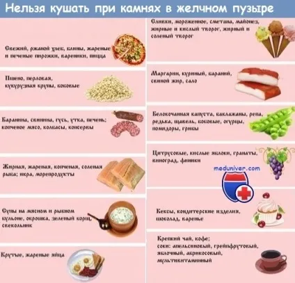 Що можна і не можна їсти, якщо є камені в жовчному міхурі дієта при холециститі (що не можна їсти при холециститі) Що можна і не можна їсти, якщо є камені в жовчному міхурі дієта при холециститі