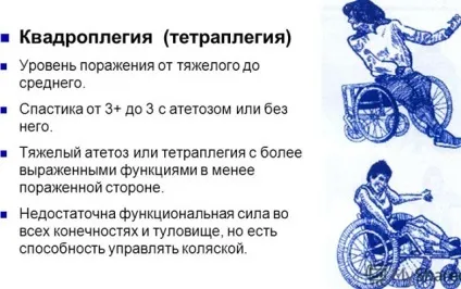 Що таке тетраплегия (Квадріплегія) як лікувати синдром, причини і прогноз (тетраплегія причини) Що таке тетраплегия (Квадріплегія) як лікувати синдром, причини і прогноз